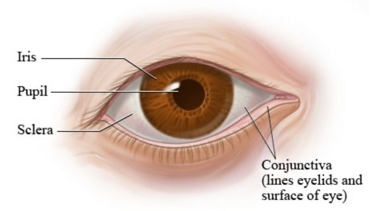 Diagram of the conjunctiva explaining where a popped blood vessel occurs on the eye surface
