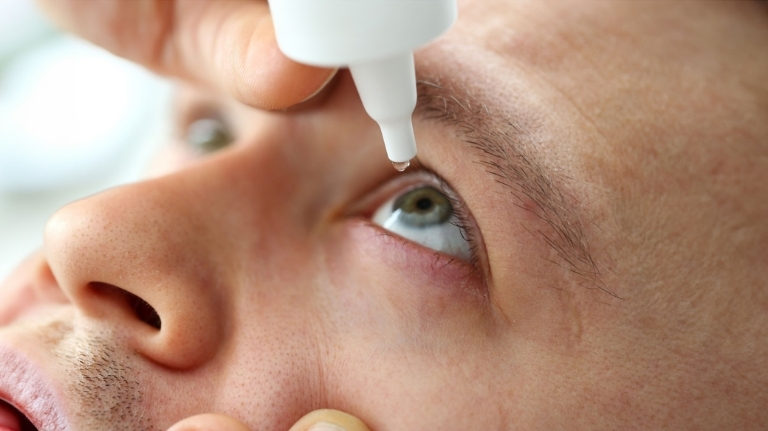 Person using artificial tears for comfort after a popped blood vessel in the eye